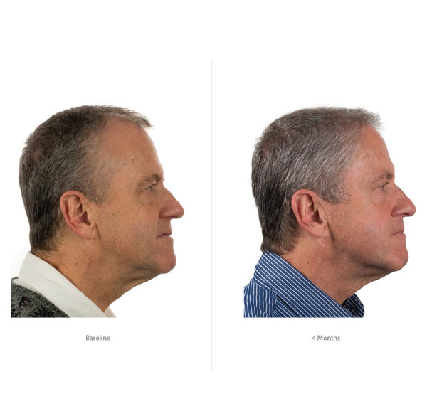 FOLIGAIN Triple Action Conditioner For Thinning Hair For Men with 2% Trioxidil - FOLIGAIN EUROPE