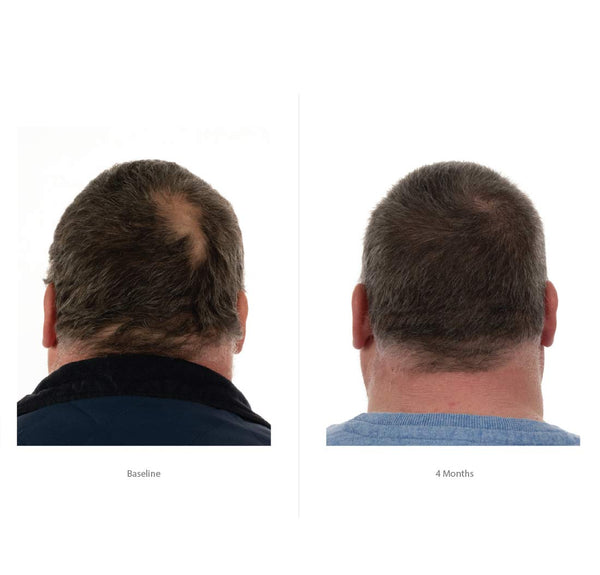 FOLIGAIN Triple Action Conditioner For Thinning Hair For Men with 2% Trioxidil - FOLIGAIN EUROPE